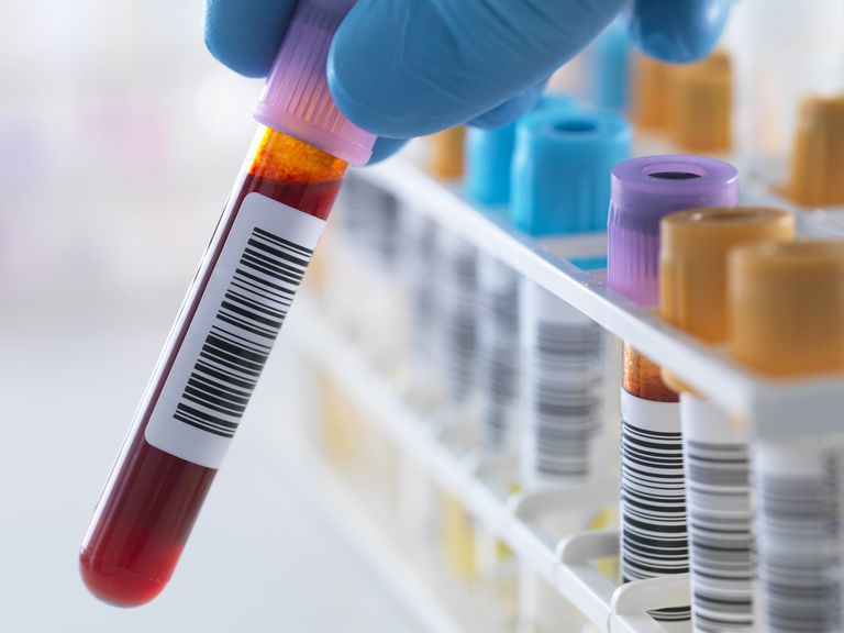 What is Included in a Blood Drug Test for Employment?
